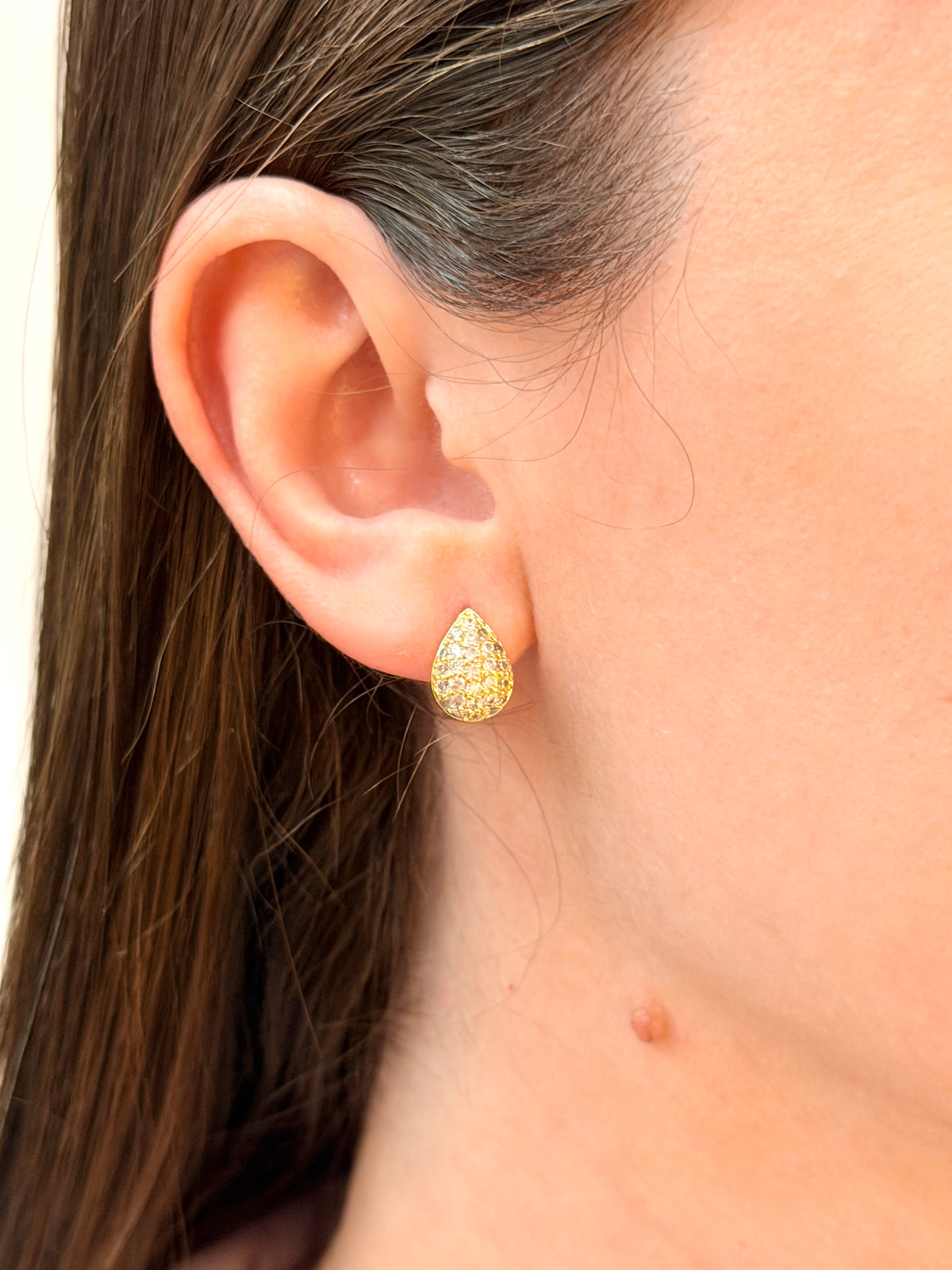 Conjunto gota com micro zircônias